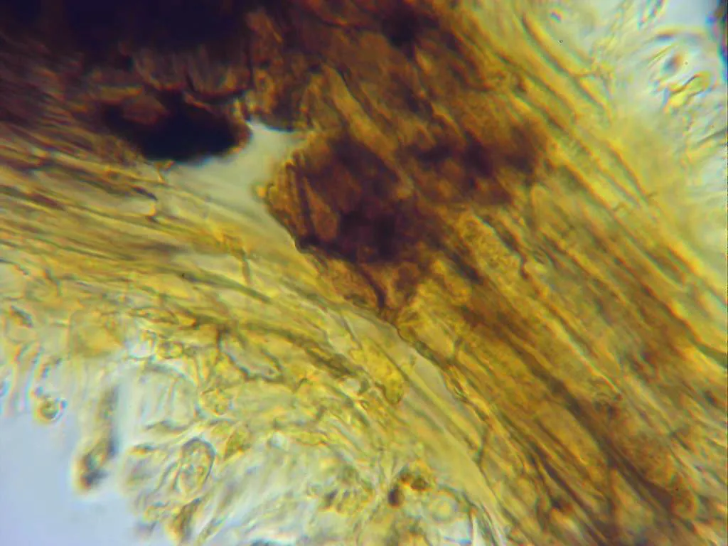 Microscopía de Neodeightonia phoenicum - 13 - Peridio Melzer